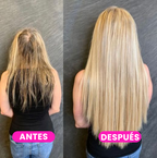 HairVital Balance™/ Detén La Caída Y Recupera El Crecimiento